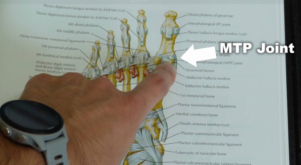 an image of the bottom of the foot with Dr. John pointing out where the MTP joint is